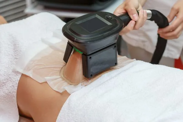 Image of person having fat freezing treatment to help weight gain Balsall
