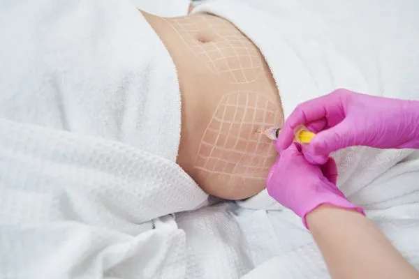 image of fat dissolving injections on love handles to help combat weight gain Balsall