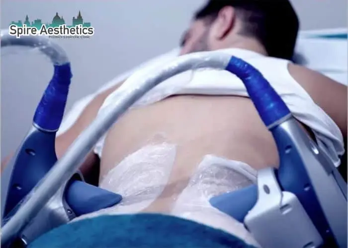 Man having fat freezing treatment done on love handles before a competitions Balsall to create a sculpted look.