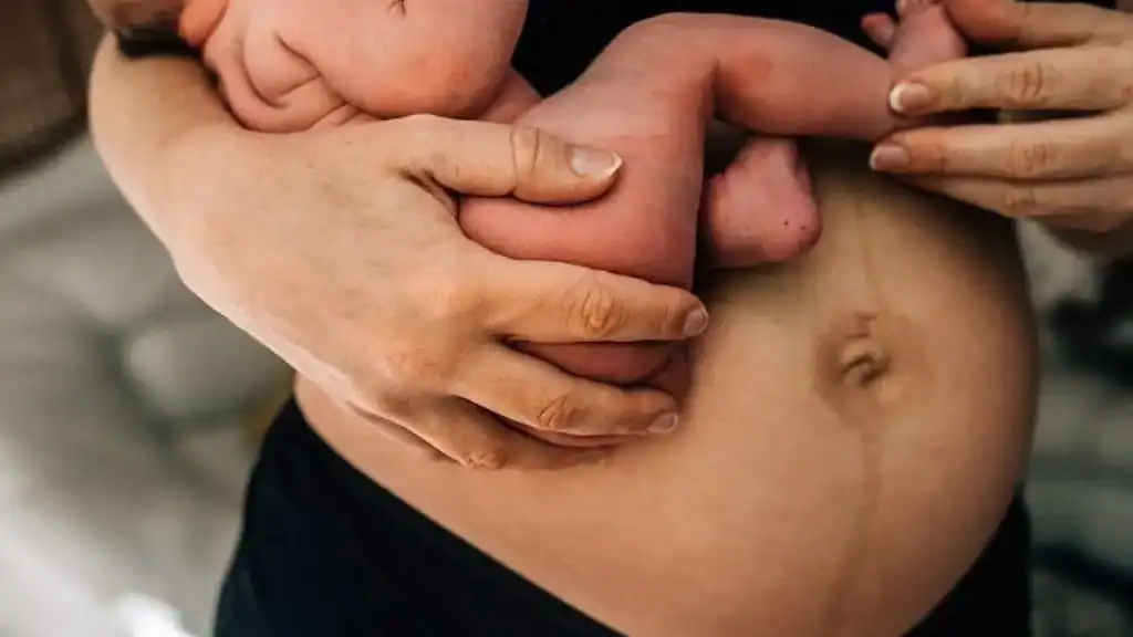 Why Is My Stomach Still Big After Pregnancy Balsall?